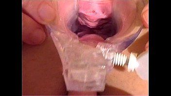 Preview 1 of Teen Have Money - Speculum sex