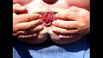 Preview 2 of Czech Gay Solarium Gay - Ass Gape Extreme MonsterExtrem Prolapse Asshole