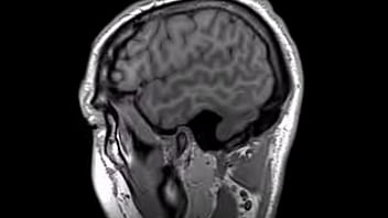 Preview 2 of Seachjav Unforms - Structural MRI animation