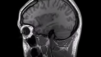 Preview 3 of Seachjav Unforms - Structural MRI animation