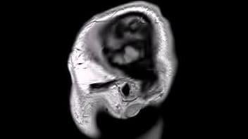Preview 1 of Seachjav Unforms - Structural MRI animation