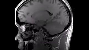 Preview 4 of Seachjav Unforms - Structural MRI animation
