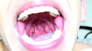 Preview 1 of Biteng Xvideos - Uvula fetish