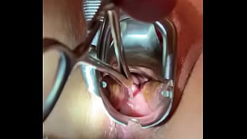 Preview 4 of Ass Flush - Sound tenaculum applying traction to cervix