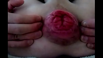 Preview 1 of Sweet Girls Rap Xxx Video - Prolapse