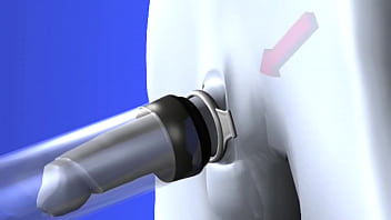 Preview 3 of Xxx Gewixt - Usando Pump Penis
