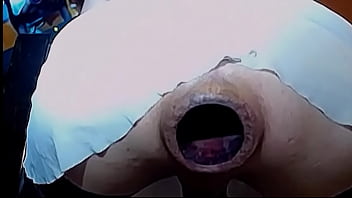 Preview 4 of Sxxxx Hit Vidio - Une bonne petite dilatattion de 8 cm
