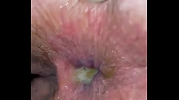 Preview 4 of Indianxxxmove - Nasty anal creampie for wife