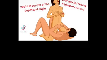 Preview 2 of My Fathee - 3 best sex positions after having a C Section