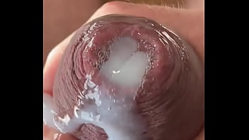 Anal Tree