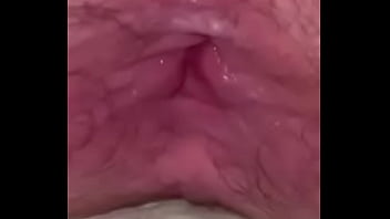 Kote Tube