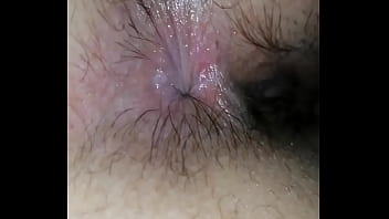 Sfilis