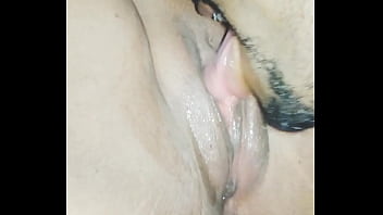 Doctor Xxxxx Hd