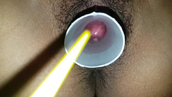 Linda Sweet Prolapse