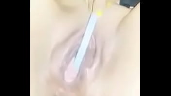 2 Preg