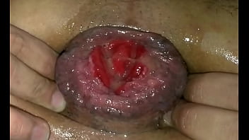 Xxxpis