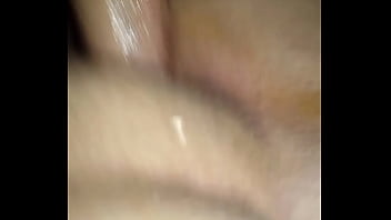 Anal Cy Sis