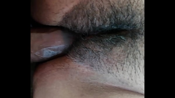 Hairy Uhd