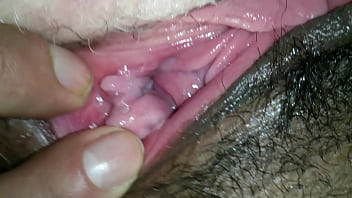 Hairy Drama