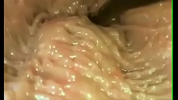 Doctor Xxx Porn Sexx Video