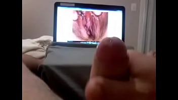Rectal Douche