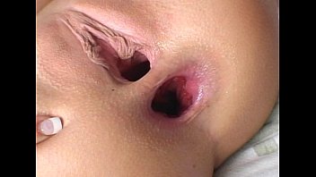 Dabal Dike Anal Sex