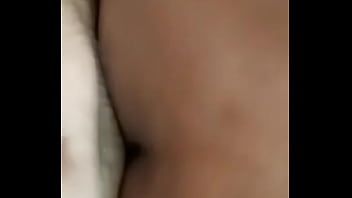 Teen With Mole On Arm10