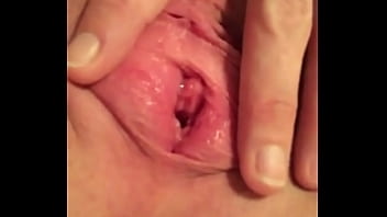 Severe Fm Beltig