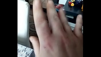 Celulite Assfuck